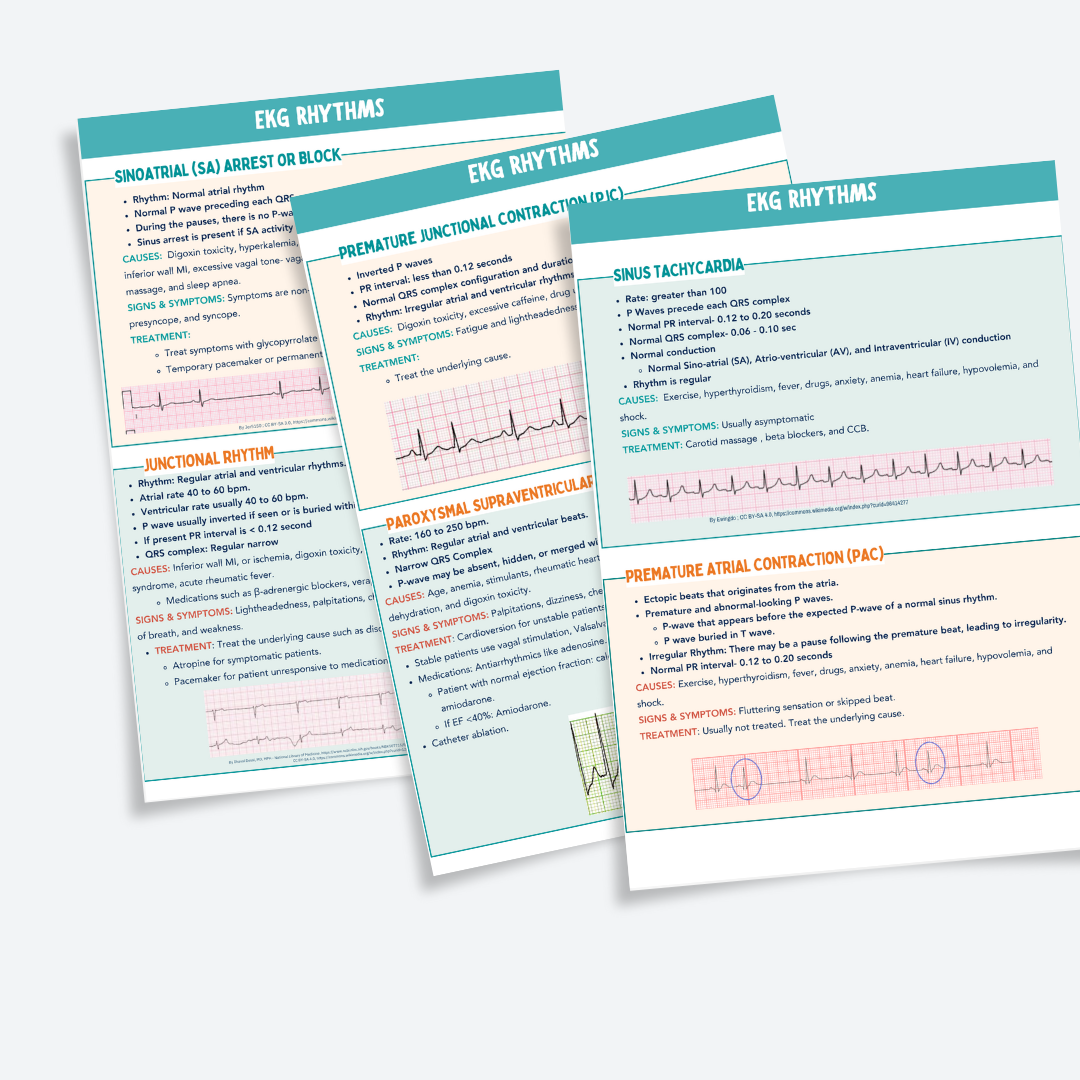 Nursing EKG Study